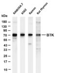 BTK Rabbit Monoclonal Antibody