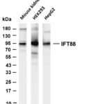 IFT88 Rabbit Monoclonal Antibody