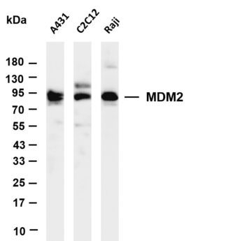 MDM2 Rabbit Monoclonal Antibody