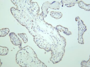MDM2 Rabbit Monoclonal Antibody - Image 2