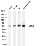 AKT Rabbit Monoclonal Antibody