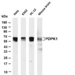 PDPK1 Rabbit Monoclonal Antibody