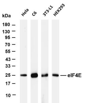 eIF4E Rabbit Monoclonal Antibody