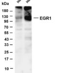 EGR1 Rabbit Monoclonal Antibody