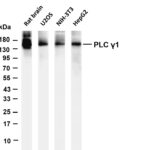 PLC γ1 Rabbit Monoclonal Antibody