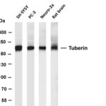 Tuberin Rabbit Monoclonal Antibody
