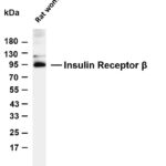 Insulin Receptor β Rabbit Monoclonal Antibody