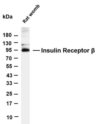 Insulin Receptor β Rabbit Monoclonal Antibody