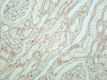 Insulin Receptor β Rabbit Monoclonal Antibody - Image 2