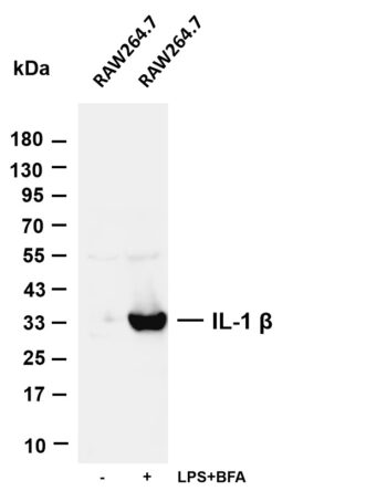IL-1 β Rabbit Monoclonal Antibody