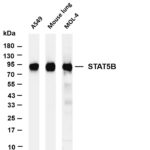 STAT5B Rabbit Monoclonal Antibody