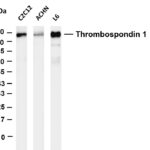 Thrombospondin 1 Rabbit Monoclonal Antibody