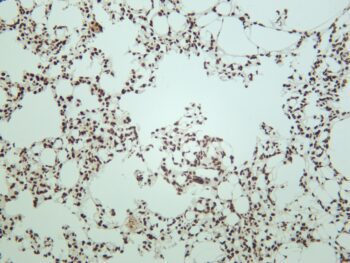 MECP2 Rabbit Monoclonal Antibody - Image 2