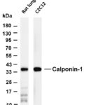 Calponin-1 Rabbit Monoclonal Antibody