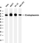 Endoplasmin Rabbit Monoclonal Antibody