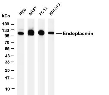 Endoplasmin Rabbit Monoclonal Antibody