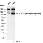 STAT5 (Phospho-Tyr694) Rabbit Monoclonal Antibody