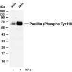 Paxillin (Phospho Tyr118) Rabbit Monoclonal Antibody