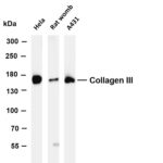 Collagen III Rabbit Monoclonal Antibody