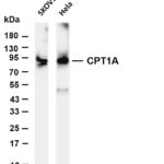 CPT1A Rabbit Monoclonal Antibody