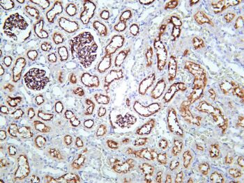 NLRP3 Rabbit Monoclonal Antibody - Image 2